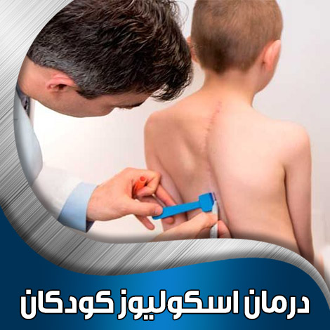 درمان اسکولیوز کودکان