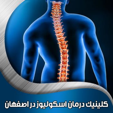 کلینیک-درمان-اسکولیوز-در-اصفهان