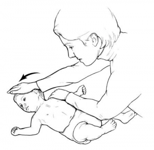 تمرین 2 اصلاح کج گردنی نوزادان