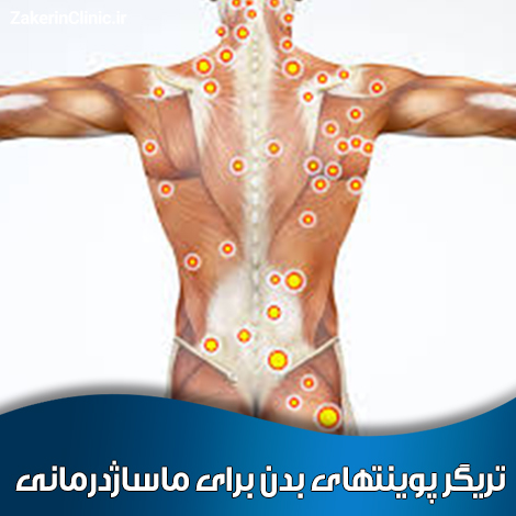 تریگر-پوینتهای-بدن-برای-ماساژدرمانی